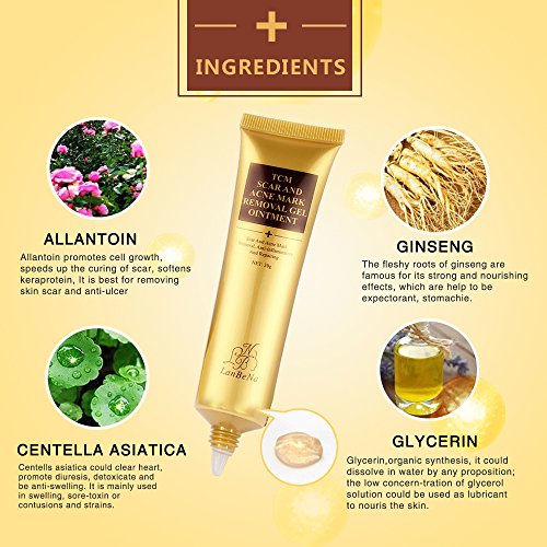 face marks removing cream