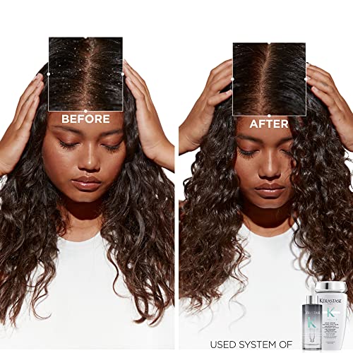 Kerastase DG-3126-684 Symbiose Anti Dandruff Shampoo Crème | Cleanses And Hydrates Scalp & Hair thumb #2