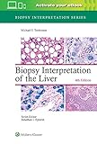 Biopsy Interpretation of the Liver