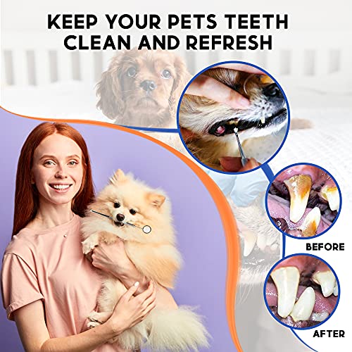 image for TrendGenics Dental Tools Plaque & Calculus Remover for Teeth Professio