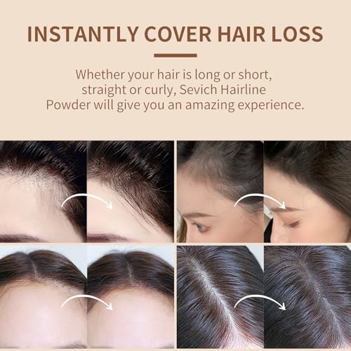 Sevich AMNAIFQNV-63 Hairline Powder,Instantly Conceals Hair Loss, Root Touch Up Powder thumb #4