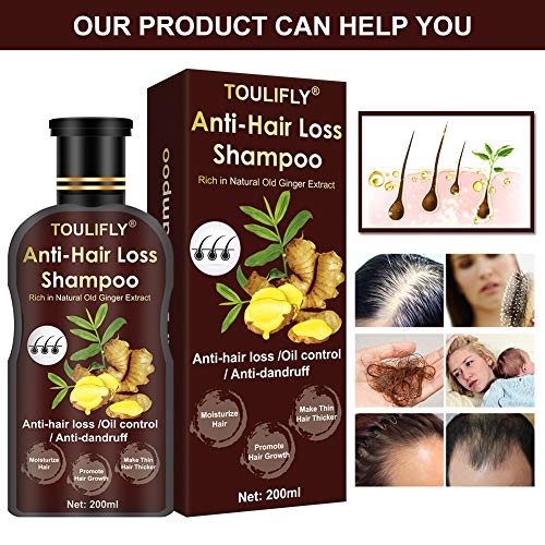Ginger Shampoo,Hair Regrowth Shampoo,Hair Loss Shampoo,Hair Growth Shampoo,Ginger Shampoo,Hair Thickening Shampoo,Hair Loss Treatments Anti Hair Loss For Thinning Hair Women Men #TOP1