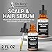 Dr. Berg Scalp & Hair Serum (Improved Formula) with Vitamin D3 & E - Clinically Tested, Paraben- and Sulfate-Free Hair Oil for Women & Men - Includes Rosemary Oil, Castor Oil & Jojoba Oil - 2 Fl oz