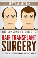 The Consumer's Guide to Hair Transplant Surgery: Everything You Wanted to Know about Hair Transplantation 1511657898 Book Cover