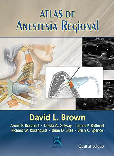 Atlas de Anestesia Regional
