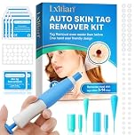 Rimuovi Verruche Rimozione, Skin Tag Remover, Kit di Rimozione Delle Appendici per Auto, Di' Addio Alle Escrescenze Cutanee! Rimuovile Facilmente: Altamente Efficace, Sicuro e Pratico