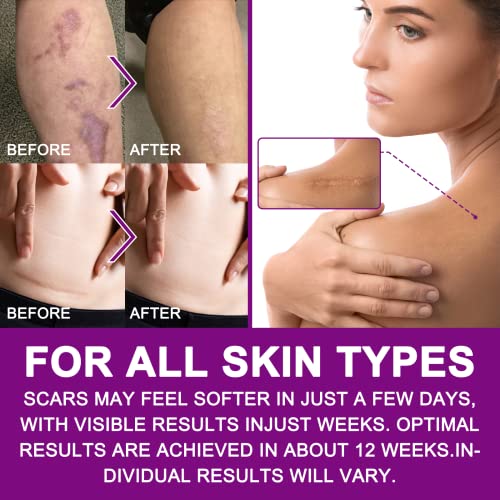 Silicone Scar Sheets (1.6”x 60”, 1.5M), Clear Scar Tape, Silicone Scar Strips, Effective Scars Away, Invisible Silicone Scar Sheets For Surgical Scars, C-Section Surgery Scar, Keloid, Burn, Acne