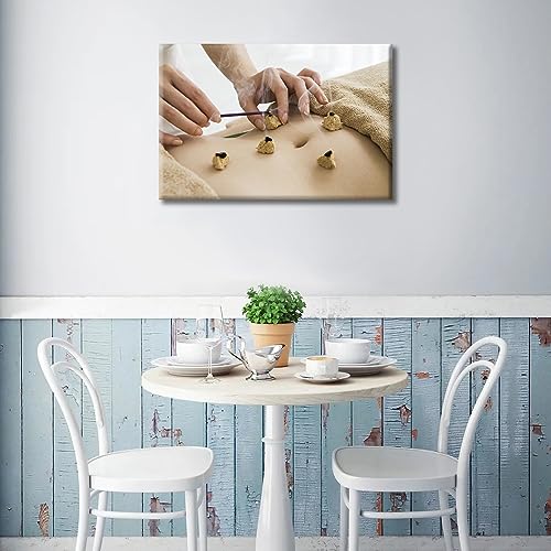 Image of Moxa Moxibustion Prints for Wall Decor Moxibustion Framed Wall Art Posters & Prints 1 Panels Nosocomium Paintings Giclee Print Gallery Packaging Artwork (12 inch Wx18 H)