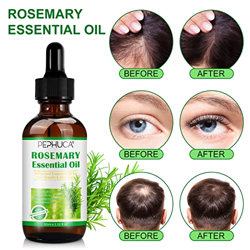 Rosemary Oil for Hair Regrowth(4.04 Fl Oz),Mulitpurpose 100% Pure Rosemary Essential Oil for Hair Loss,Hair Skin Nail Nourishment,Stimulates Hair Growth,Rid of Itchy and Dry Scalp for Unisex - Image 3