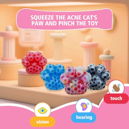 4 Pcs Pimple Popping Fidgets- TPR Stress Relief Ball for Adults, Realistic Acne Popping Simulation Sensory Fidget Toys, Pick Dig and Peel Great for Dermatillomania ADHD, and OCD by Ddnikahh - Used condition - Image 2