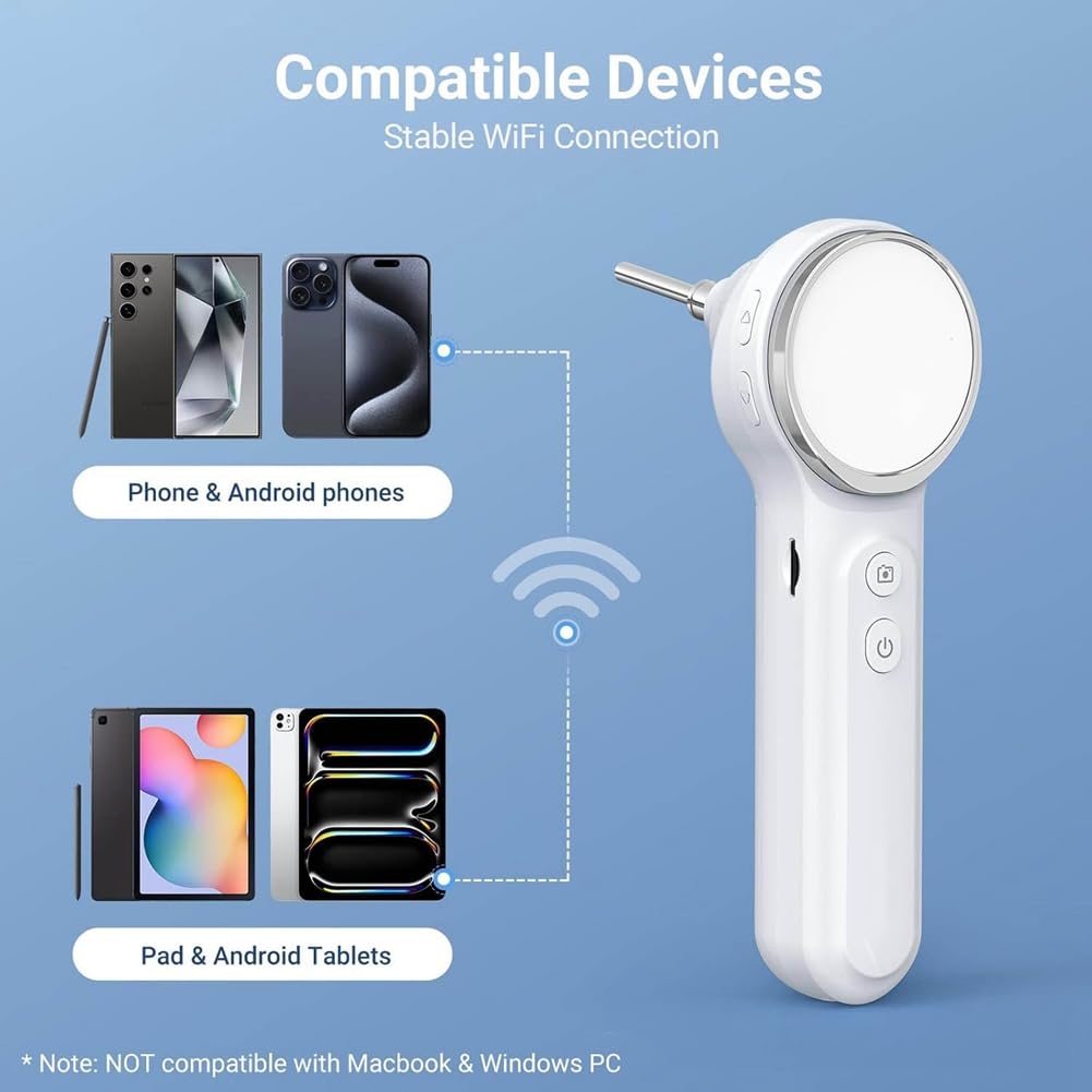 1,85 Pouces IPS Screen Otoscope Numérique, 720p HD Ear Removal Tool Camera, Otoscope avec Lumière, Caméra D'Oreille Vidéo