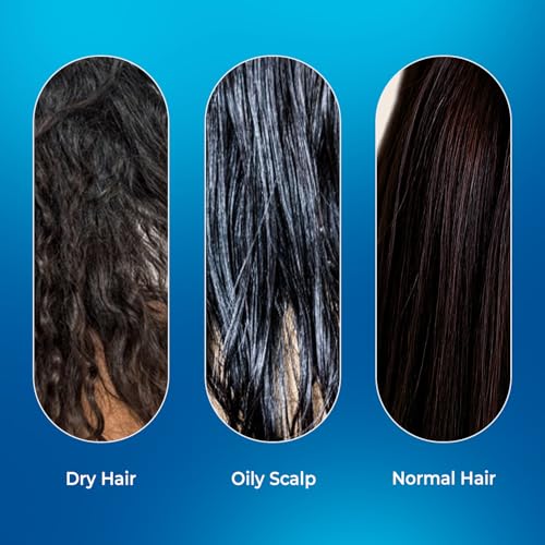 Image of VINR Rosemary Hair Spray for Hair Growth | Rosemary Water & Mint Scalp Strengthening Spray | Anti Hair Fall | Hair Mist | Lightweight Hair Growth Mist | All Hair Types 100 ml