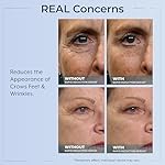 Plexaderm Rapid Reduction Eye Serum - Visibly Reduces Under-Eye Bags, Wrinkles, Dark Circles, Fine Lines & Crow's Feet Instantly, Anti Aging Wrinkle Remover for Face, Full Size Tube - Image 5