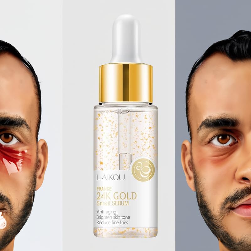 Miniatura 5 de EKHAYA - Suero reparador de mucina de caracol suero hidratante de esencia de mucina de caracol con vitamina C para rejuvenecimiento de la piel,