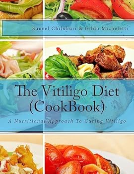 Paperback The Vitiligo Diet (CookBook): A Nutritional Approach To Curing Vitiligo Book