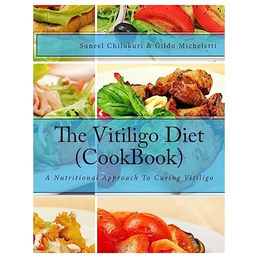 The Vitiligo Diet (CookBook): A Nutritional Approach To Curing Vitiligo