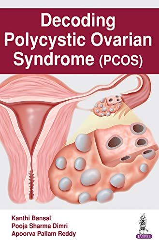 Decoding Polycystic Ovarian Syndrome (PCOS)
