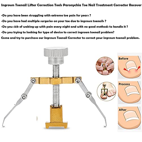 Ingrown Toenail Treatment Kit, Professional Ingrown Toe Nail Recover Correction Tool, Pedicure Tools For Nail Correction, Softening And Easy Trimming #TOP7