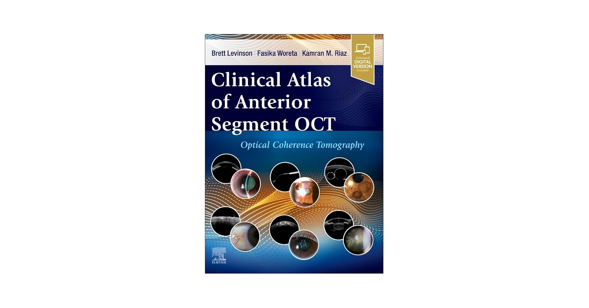 Amazon | Clinical Atlas of Anterior Segment OCT: Optical