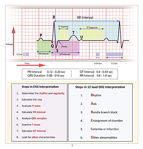 Healthing Aprn World Ekg Pocket Card thumb #3