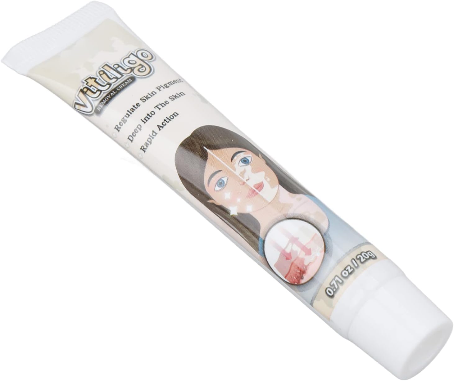 White Spots Vitiligo Cream, Herbal Extract Portable Vitiligo Cream Mild for Health Care for Skin Pigmentation