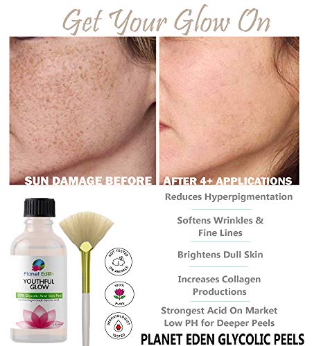 Planet Eden ZC1A10981 50% Glycolic Acid Skin Chemical Peel Kit thumb #2