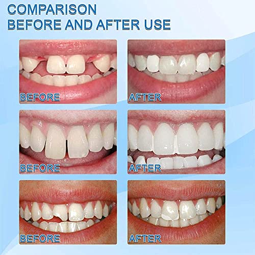 image for SHxxyljh Tooth Repair Kits,2Pcs 30ml Dental Repair Denture Repair Bead