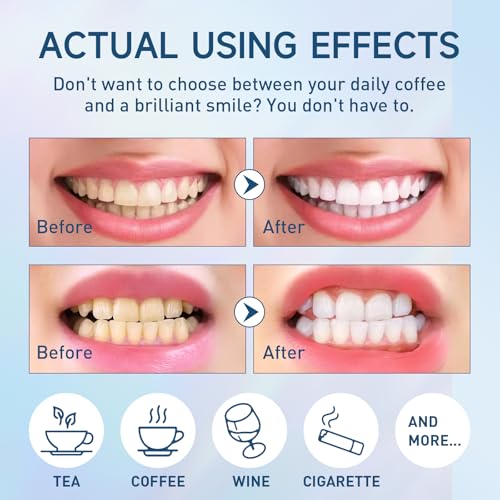 Image of Tooth Whitening Powder Remineralizing Teeth Whitening Powder Instant Tooth Powder Mint Flavor Teeth Whitener Toothpaste Powder for Tooth Stain Removal 50g /1.76oz