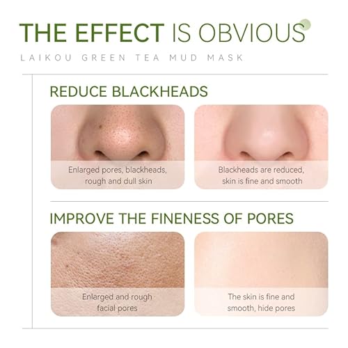 Akary Clay Mask Skin Care Green Tea Mud Mask, Natural Organic Green Tea Mud Mask With Hyaluronic Acid, Deep Cleansing Blackhead Removal Face Mask Nourishing Hydration Facial Mask For Face And Body #TOP5