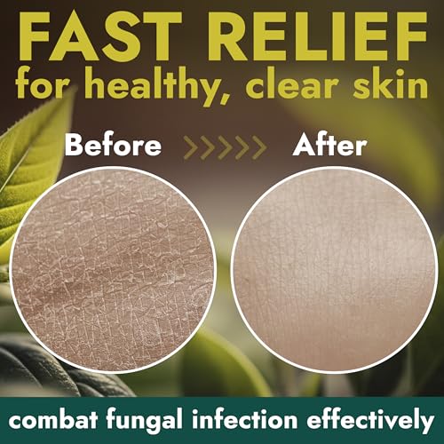 Image of Antifungal Body Wash with Tea Tree Oil for Ringworm & Jock Itch Treatment