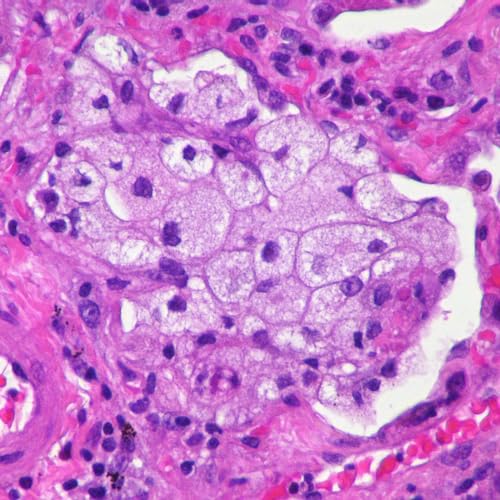 Image of 100-Set Prepared Microscope Pathology Slides for Human Medical Education