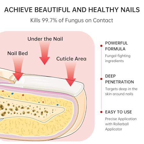QQE Nail Fungus Treatment Extra Strength - 1% Tolnaftate, Treats Nail Fungal Infections, Repairs Damaged Nails, Gentle Plant-Based Formula for Thickened and Discolored Nails 0.51 fl.oz