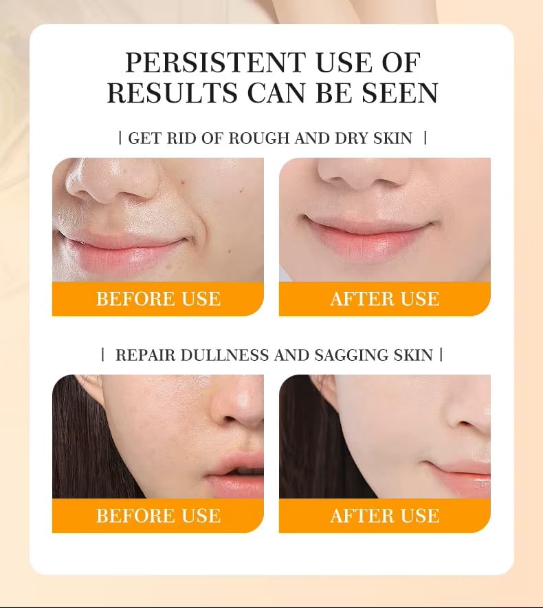 Vitamin C Glow Serum with Hyaluronic Acid and Vitamin E for Face - Brightening, Hydrating and Moisturizing Facial Serum for Radiant, Even-Looking Skin - Lightweight, Non-sticky, 1 Fl. Oz - Image 6