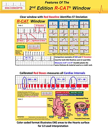 Fenêtre R-Cat EKG 2e édition solution lecture ECG sans erreur de tracé