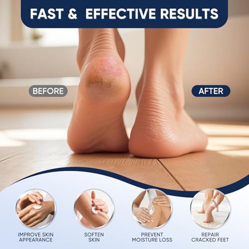 Urea Cream 40 Percent for Feet Maximum Strength, Urea Cream 40% Plus Salicylic Acid 2%, Foot & Hand Cream for Dry Cracked - Image 4