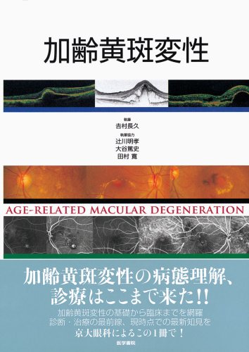 無料電子書籍 アプリ 加齢黄斑変性 バイ