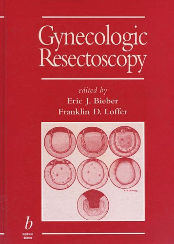 Gynecologic Resectoscopy (Minimally Invasive Gynecology): 9780865423497 ...