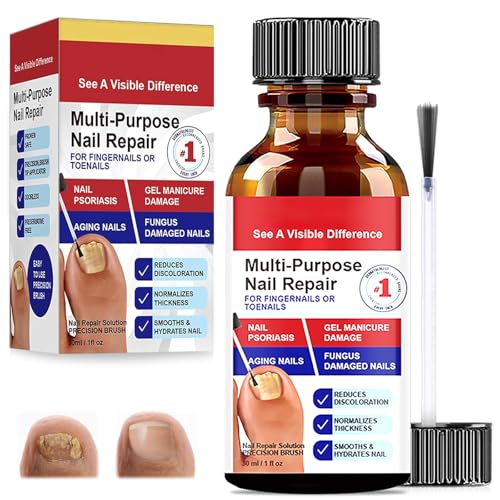 30ml Reparadores De Uñas Solución, Tratamiento De Uñas Los Pies, Pueden Calmar Y Nutrir Las Fortalece La Uña, Cuidado Diaria Y Mejora Aspecto, Para Decoloradas Los Pies