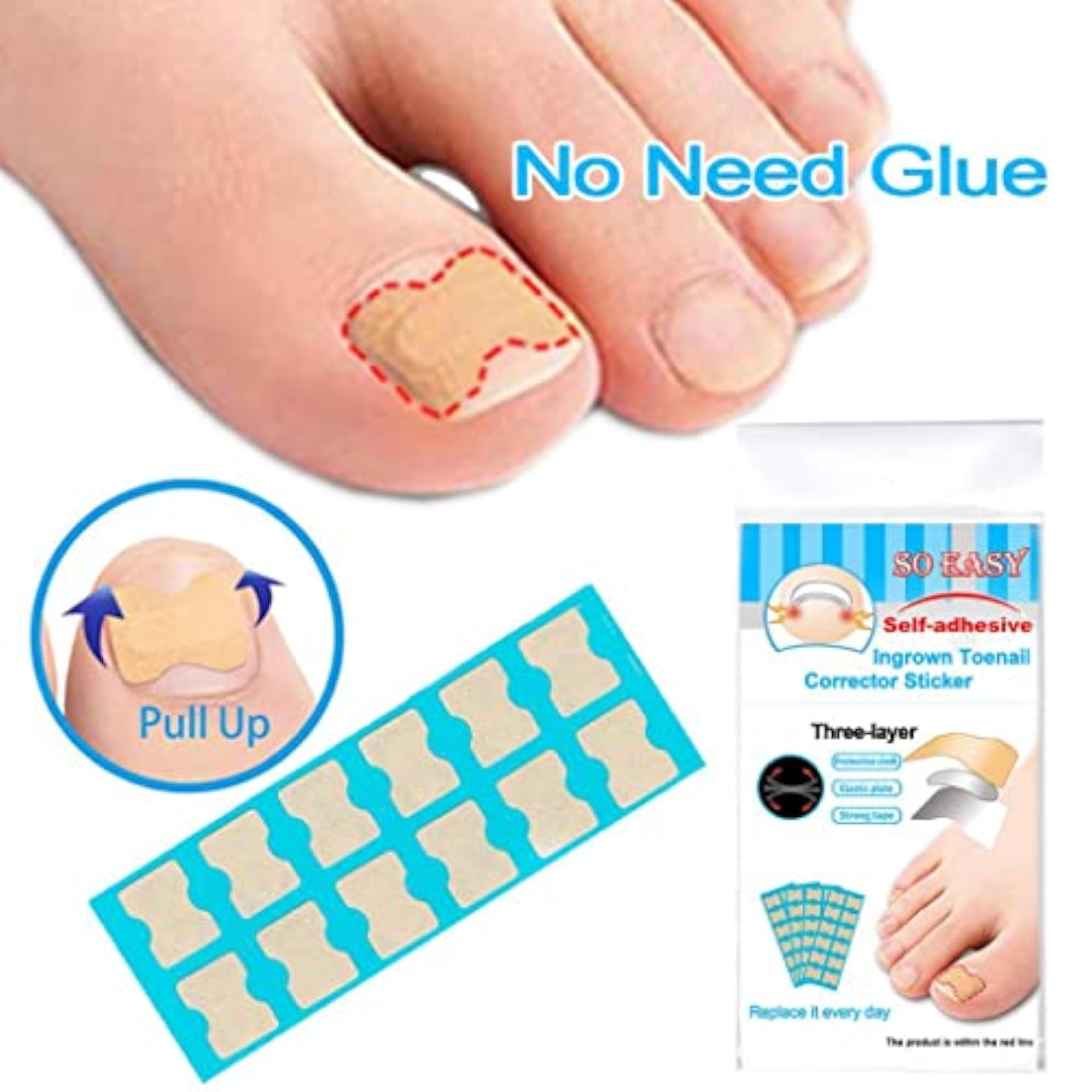 Ingrown Toenail Corrector Stickers 36 Sheets, Nail Treatment