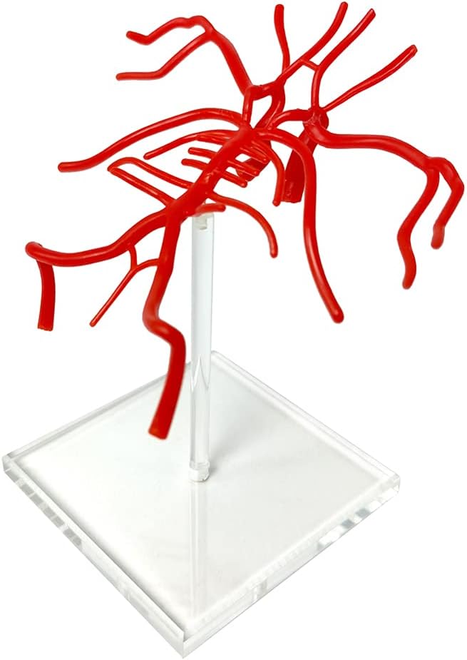 Brain Artery Model, Life Size Intracranial Artery Model, Shows Internal Carotid Artery, Willis Circle and Basillary Artery & Their Branches. On a Plexiglass Base