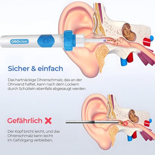Oroclear ohrenschmalz-sauger Original, Podomax Oroclear Ohrenschmalz-Reiniger, Entferner Sauger, Sicheres Und Weiches Ear Cleaner, Mit 2 Waschbaren Ersatzköpfen Und Batterie