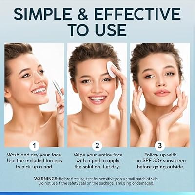 NUVADERMIS 35% Glycolic Acid Peel Pads Exfoliating Facial Resurfacing for Blackheads, Dark Spots, and Acne Safe for Sensitive Skin 60 Double-Sided Pads - 2 Pack