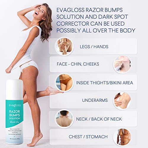 Evagloss Razor Bumps Solution- After Shave Repair Serum for Ingrown and Burns, Dark Spot Corrector Skin Lightening, Roll-On for Men and Women -100g