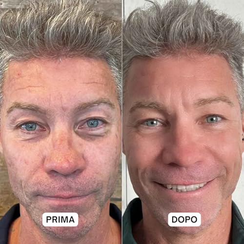 Dr. Sea - Crema Viso & Contorno Occhi Ultra-Idratante - Lifting & Anti-Fatica - Acido Ialuronico & Olio Di Avocado - 50Ml - 5