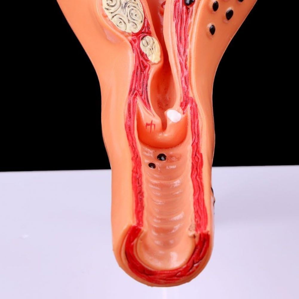 Modèle d'utérus et d'ovaire Grandeur Nature Modèle Anatomique d'utérus et d'ovaire pathologique Modèle Anatomique pour étude en Coupe Outil pédagogique Modèle de matériel médical