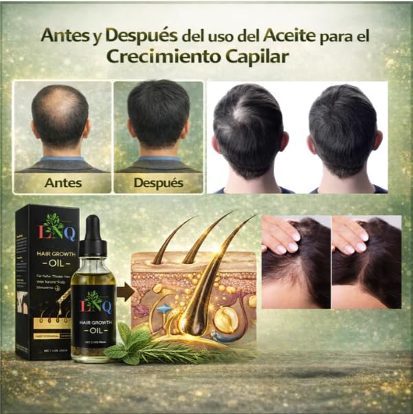 Aceite Capilar Herbal LNQ – Fórmula Natural para Crecer, Fortalecer y Engrosar el Cabello