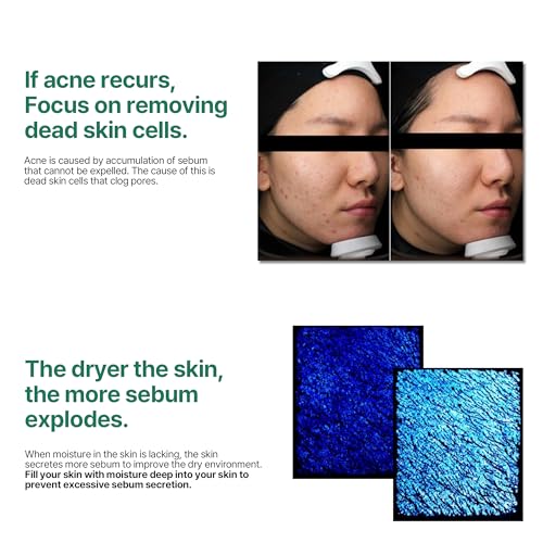 SOME BY MI AHA BHA PHA 30 Days Miracle Toner + Bye Bye Blackhead 30 Days Miracle Green Tea Tox Bubble Cleanser - Thumbnail 4