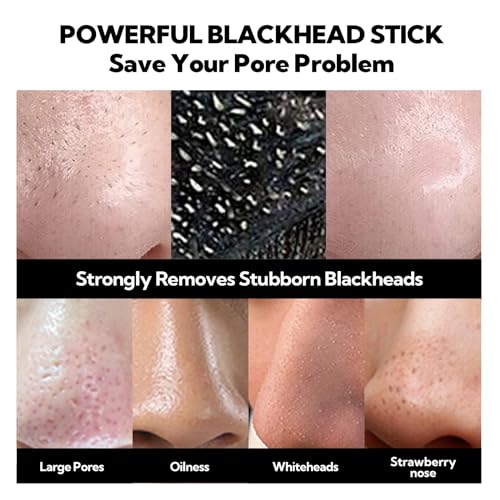 Lanbena Upgraded 2.0 Bamboo Charcoal Blackhead Remover Mask, 60 Pcs Nose Strips, Peel Off Face Mask Pore Whiteheads Cleanser Strawberry Nose Purifying thumb #2