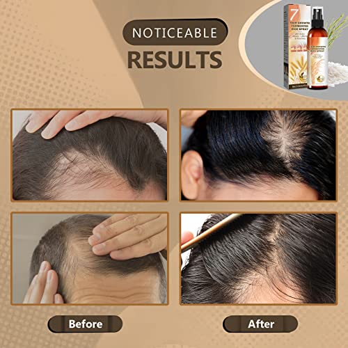 Rice Water For Hair Growth, Organic Fermented Hair Growth Spray Hair Growth Treatment Leave-In Mist With Rosemary Biotin Keratin For Hair Loss Men And Women-4 Fl Oz #TOP4