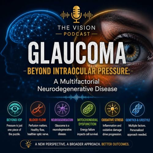 Glaucoma Beyond Intraocular Pressure.html cover art